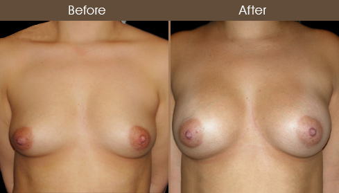 20202805155550_B83-Front